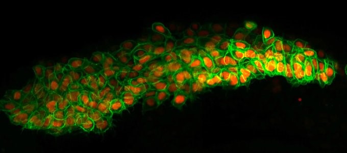  fluorescently tagged neural crest cells migrate through the tissues of a zebra fish embryo. The nuclei of the cells appear red; their membranes are green.