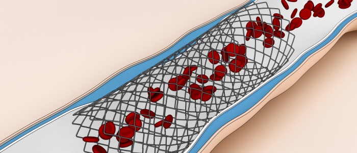 Image of Stent for LKAS STUDENTSHIP award