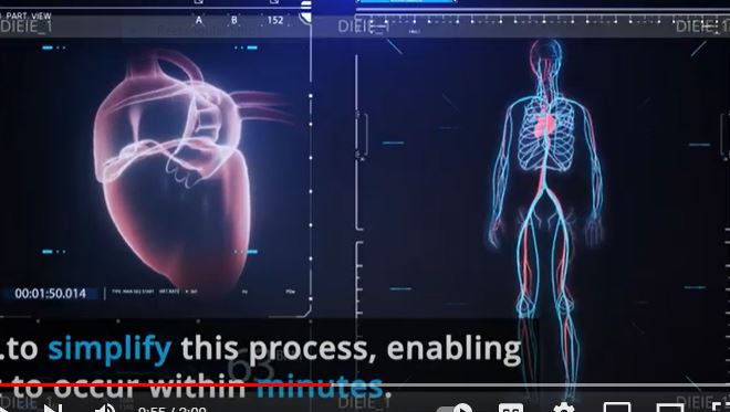 Optimizing Cardio-Mechanic Models for Diagnosis and Treatment of Heart Disease